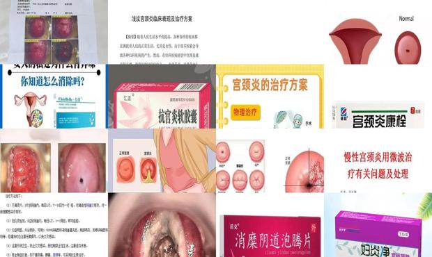 汕头治疗妇科医院哪家好 - 汕头治疗宫颈炎