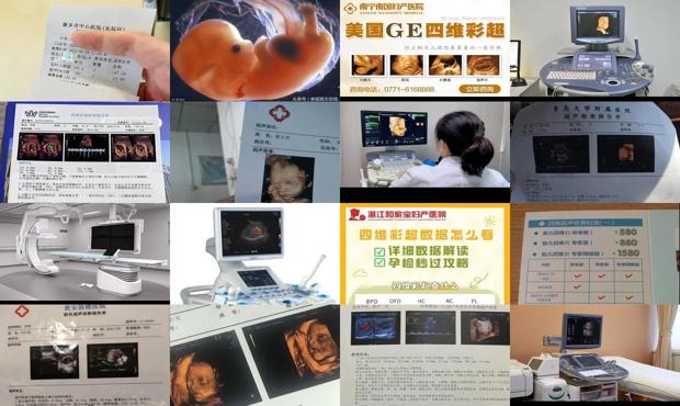 汕头天佑妇产医院做四维多少钱 - 汕头四维彩超多少钱