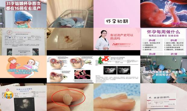 怀孕满16周 - 汕头怀孕16周能做流产吗