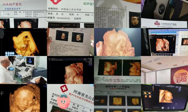 汕头哪里有四维彩超机器 - 汕头哪里有四维彩超