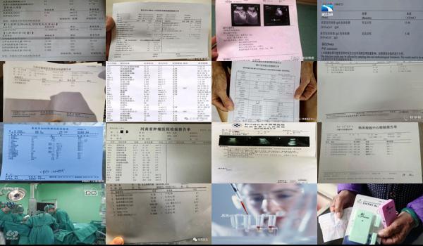 汕头孕早期抗凝血检查要多久出结果 - 汕头孕早期抗凝血检查要多久