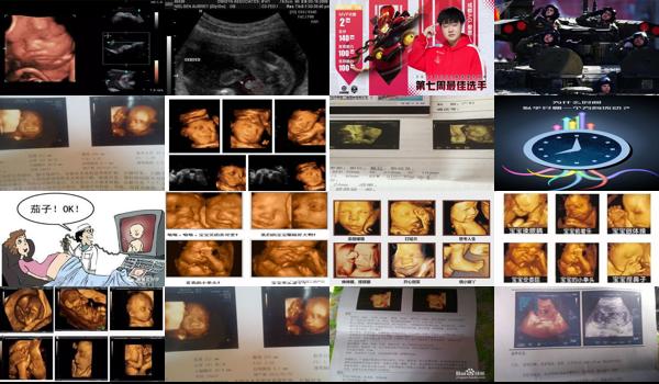 汕头双胎四维最佳时间是多少周啊 - 汕头双胎四维最佳时间是多少周