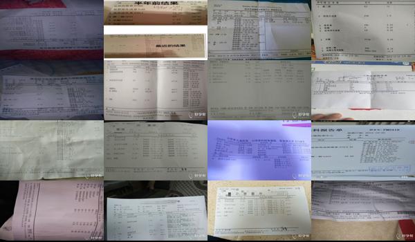 汕头激素六项的检查怎么检查多少钱 - 汕头激素六项的检查怎么检查