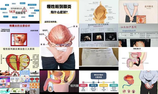 汕头四维彩超多少钱汕头四维彩超