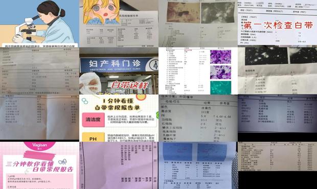 汕头哪里检查妇科比较好 - 汕头怎么检查白带