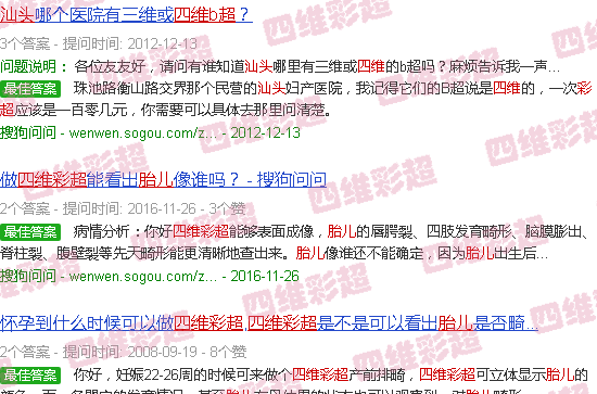 汕头四维彩超看胎儿