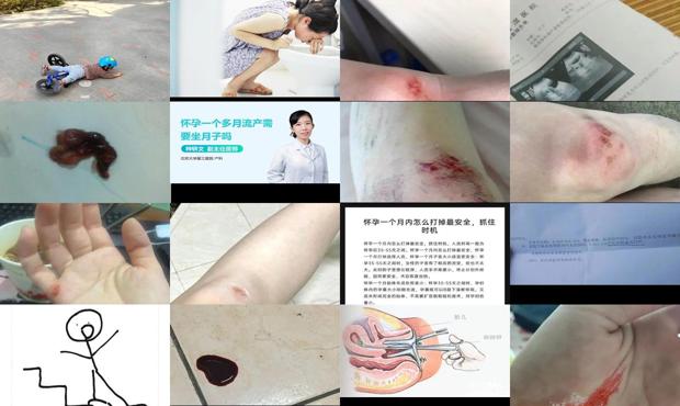 汕头真情追踪怀孕 - 汕头怀孕一个多月摔了一跤会流产吗
