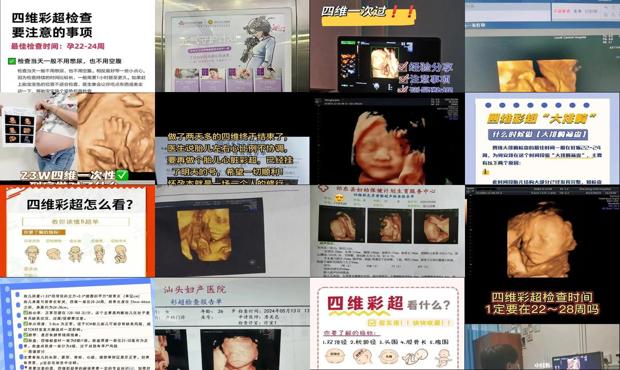汕头四维彩超的*佳时间