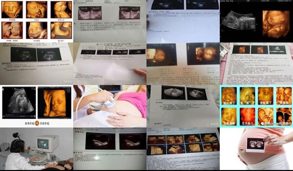 汕头子宫彩超能检查早孕么吗 - 汕头子宫彩超能检查早孕么