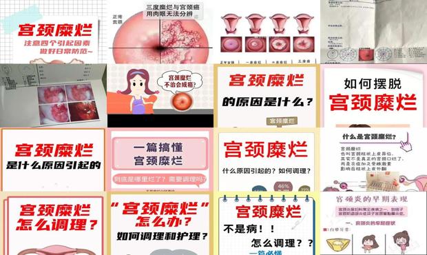 宫颈糜烂现在叫 - 汕头宫颈糜烂是怎么引起的