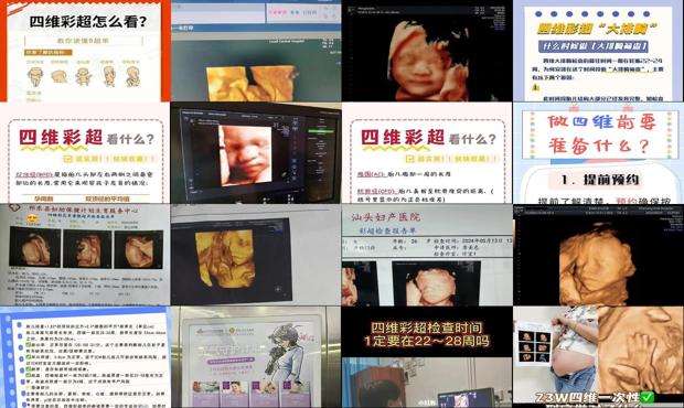 汕头四维彩超*佳时间