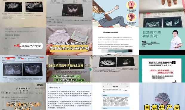 汕头流产医院 - 汕头自然流产后怎么判断要不要清宫
