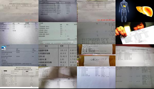 汕头乙肝检查挂什么科室 - 汕头乙肝检查挂什么科