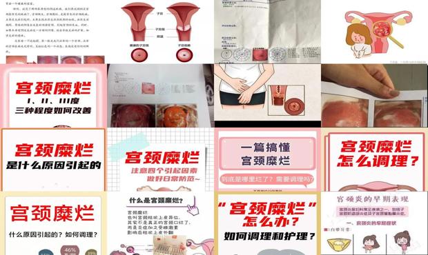 宫颈糜烂正规医院一般多少钱 - 汕头宫颈糜烂怎么引起的
