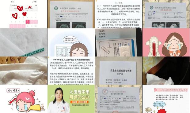 流产一个去可以吗 - 汕头流产一个多月了为何月经不来