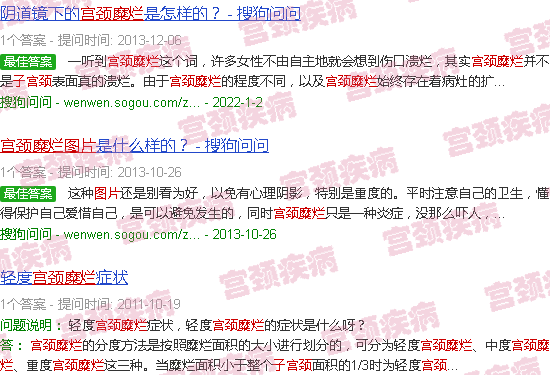 汕头宫颈糜烂图片