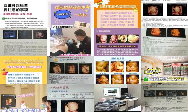 汕头四维彩超什么时候做