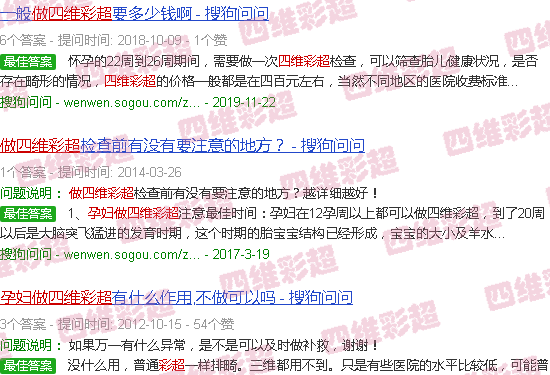 汕头孕妇做四维彩超