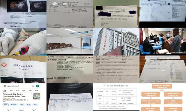 汕头医院bc指什么检查什么