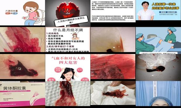 流产五十天又怀孕了对身体好吗 - 汕头流产五十天来了月经产特别多法怎么办