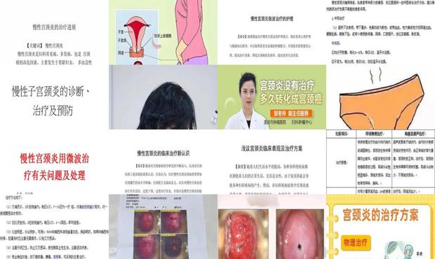 慢性宫颈炎是怎么引起的 - 汕头宫颈炎怎么治疗