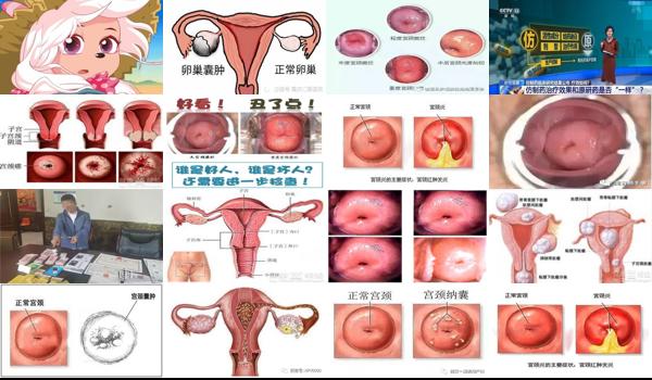 汕头宫颈囊肿激光治疗多少钱啊 - 汕头宫颈囊肿激光治疗多少钱