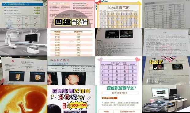 汕头四维彩超价格表