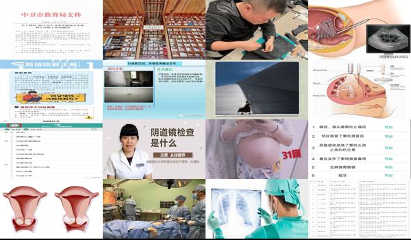 做宫颈镜多少钱 - 汕头做宫颈镜查注意什么