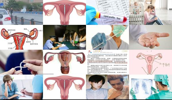 汕头女性上环时要做什么检查呢 - 汕头女性上环时要做什么检查