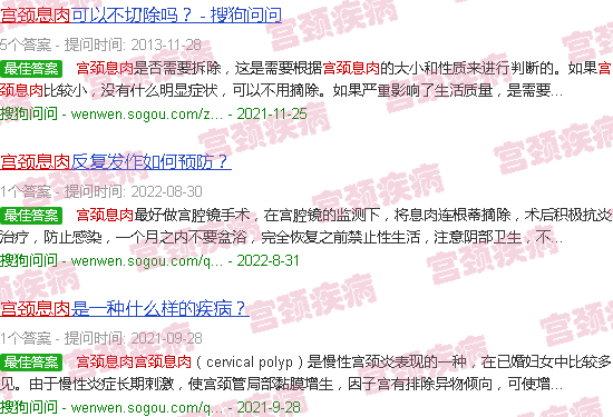 汕头宫颈息肉