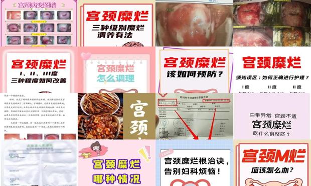 宫颈糜烂骗局 - 汕头宫颈糜烂怎么根治