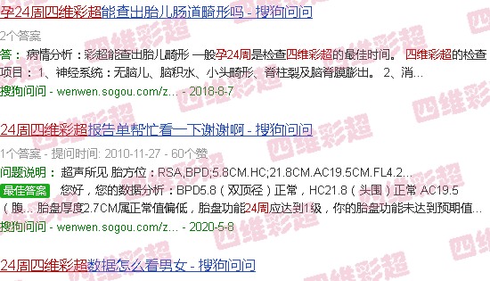 汕头孕24周四维彩超