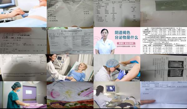 y道分泌物 - 汕头阴道分泌物检查结果
