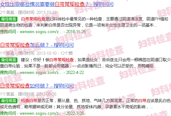 汕头白带常规检查
