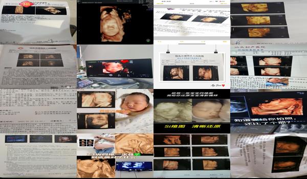 四维7个月可以做吗 - 汕头四维七个月能做吗