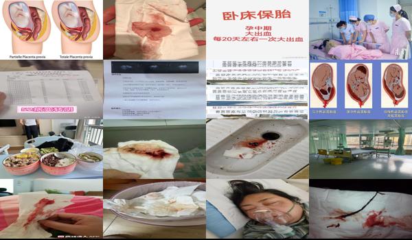 汕头宫颈大出血医院 - 汕头宫颈大出血