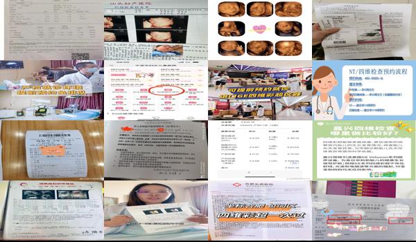 汕头四维检查预约电话 - 汕头四维检查预约