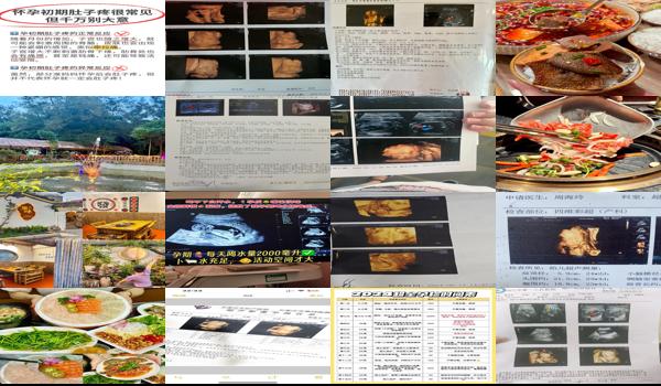 四维b超检查价格 - 汕头四维bi检查是什么意思