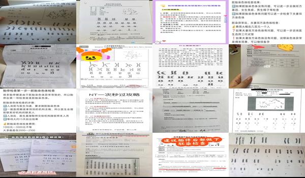 汕头什么叫染色体检查医院 - 汕头什么叫染色体检查