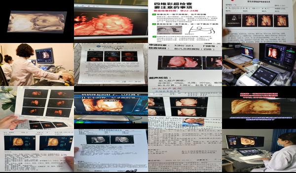 汕头孕妇检查四维是什么医院 - 汕头孕妇检查四维是什么?