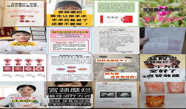 汕头治疗宫颈糜烂大概要多少钱呢 - 汕头治疗宫颈糜烂大概要多少钱