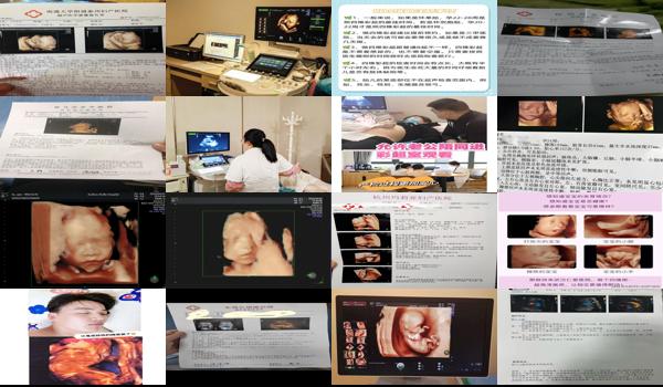 汕头什么样单位才有资质做四维彩超呢 - 汕头什么样单位才有资质做四维彩超