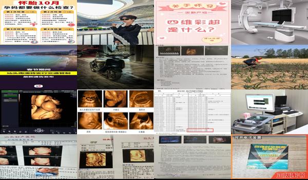 汕头什么时候可以四维彩超 - 汕头什么时候可以四维