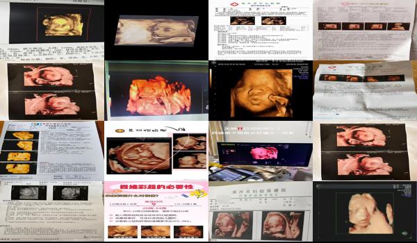 汕头三维彩超和四维彩超那个好一点 - 汕头三维彩超和四维彩超那个好