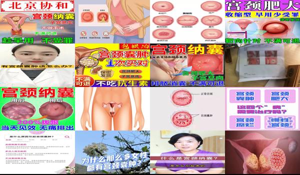 宫颈肥大宫颈糜烂宫颈囊肿怎么治疗 - 汕头宫颈糜烂宫颈肥大宫颈襄肿怎么治疗