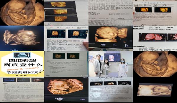 汕头妇产科医院有四维彩超吗多少钱 - 汕头妇产科医院有四维彩超吗?