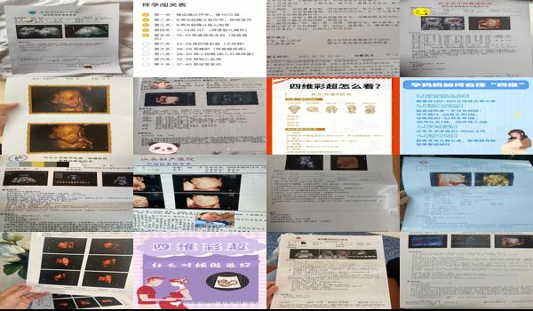 汕头怀孕什么时候查四维彩超 - 汕头怀孕什么时候查四维