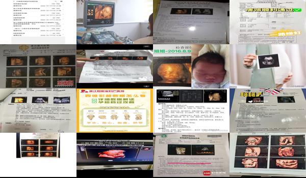汕头查四维彩超要多少钱一次 - 汕头查四维彩超要多少钱