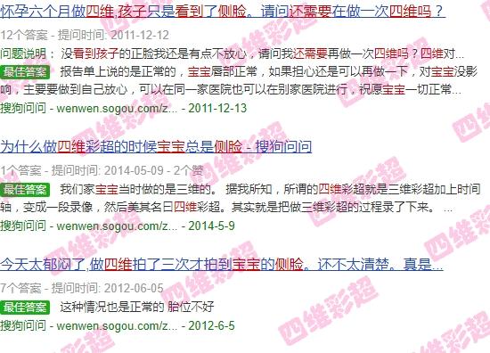 四维只看见胎儿的侧脸合格吗 - 汕头四维只看到宝宝侧脸,还需要重新四维吗