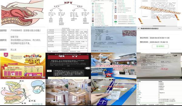 汕头查子宫去哪里查比较好 - 汕头宫颈查什么项目